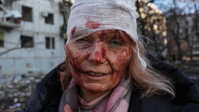 Russia intervention hitting cities all across Ukraine