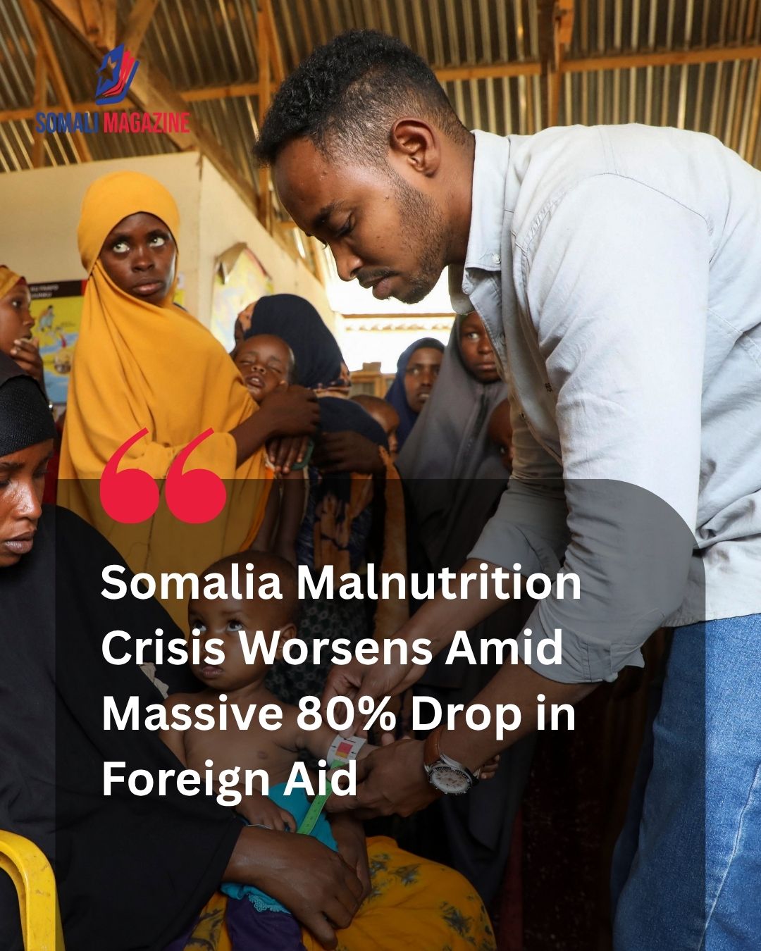 Severe Aid Reductions Threaten Lifesaving Efforts as Somalia Malnutrition Response Faces Dramatic Funding Drop